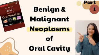 Benign and Malignant Tumors of Oral Cavity  Oral Pathology  Part 1 [upl. by Odnolor]