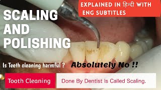 How Scaling is done   Teeth cleaning  Scaling and Polishing [upl. by Storfer]