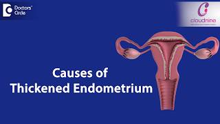 What causes Endometrial thickness  DrSmitha Sha of Cloudnine Hospitals  Doctors Circle [upl. by Irvin]