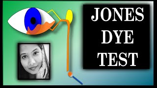 Jones Dye Test  1 amp 2  Lacrimal Drainage Disorders  Oculoplasty [upl. by Robert621]