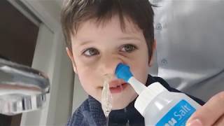 Cómo limpiar la sinusitis a un niño [upl. by Singband]