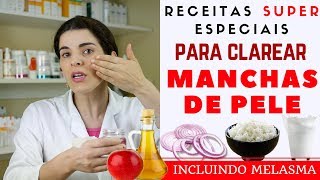 Acabe com as MANCHAS NA PELE inclusive MELASMA  Receita Caseira [upl. by Aisyla602]