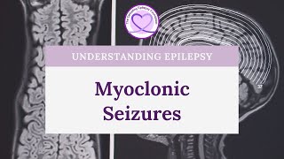 What are Myoclonic Seizures [upl. by Asirrom]