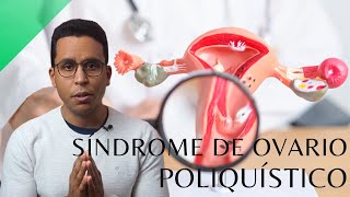 Síndrome de Ovario Poliquístico Causas Síntomas Diagnóstico y Tratamiento [upl. by Keven]