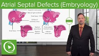 Atrial Septal Defects – Embryology  Lecturio [upl. by Nonnel]