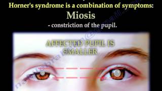 The Brachial Plexus amp Horners Syndrome  Everything You Need To Know  Dr Nabil Ebraheim [upl. by Leesa203]