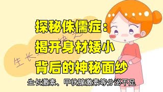 【科普】探秘侏儒症：揭开身材矮小背后的神秘面纱 [upl. by Jesus]