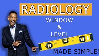 Tips To Remember Window amp Level In Radiology [upl. by Treva932]