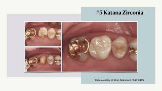 Zirconia 101 10 of 11 Clinical cases [upl. by Casavant]