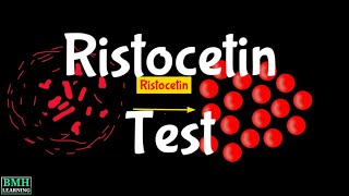 Ristocetin Test  Ristocetin Assay  Ristocetininduced Platelet Aggregation  RIPA [upl. by Olnton]