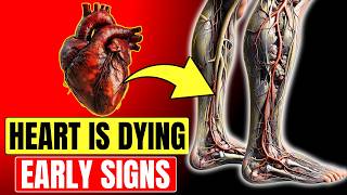 10 Warning Signs of Blocked Heart Arteries In Legs and Feet Dont Ignore These Signals [upl. by Atteuqnas]