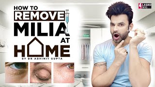 How to Remove Milia at Home  Causes Types amp Treatment by DrAbhinitgupta [upl. by Dorella]