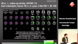 Interventionelle Therapie bei akuter neurologischer Symptomatik  Hannes Deutschmann [upl. by Mabelle]