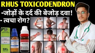 Rhus Tox 200 Homeopathic Medicine uses  Rhus Toxicodendron 30 uses in Hindi [upl. by Asilrahc]