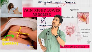 pain right lower abdomen  know the causes 🚨 [upl. by Ttenneb838]