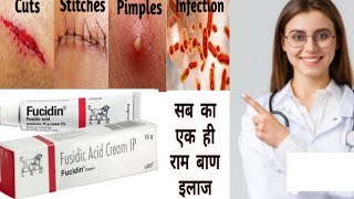 Fucidin Cream  Fucidic Acid Cream  ointment हिन्दी में Uses side effects  Honest review [upl. by Eltsyrhc]