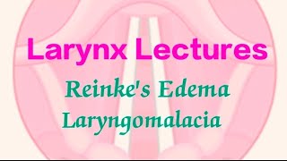 Reinkes Edema  Laryngomalacia [upl. by Rowley]