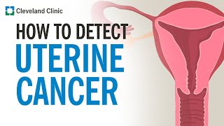 How Is Uterine Cancer Diagnosed [upl. by Nohsal]