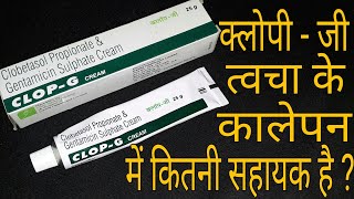 Clop  G Cream त्चचा के कालेपन को 100 मिटाता है [upl. by Houlberg852]