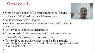 Muscular Dystrophy  Myotonic Dystrophy  Part 10 [upl. by Rochus763]