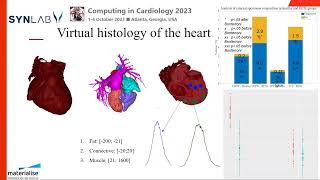 Advancing assessment and diagnostic with the use of virtual histology  PAOLO GARGIULO [upl. by Camfort]