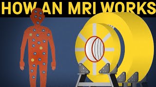 How does an MRI machine work [upl. by Robb501]