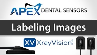 Apteryx XrayVision Labeling Images  Apex Dental Sensors  Training [upl. by Fanchon]