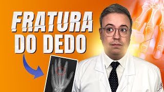 Fratura das falanges proximal e média  Dedo quebrado [upl. by Falito]