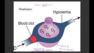 Unit 4 Respiratory [upl. by Moriah281]