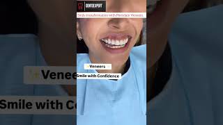 Fluorosis Stained Teeth Treated with Porcelain Veneers shorts cosmeticdentistry dentist yt [upl. by Helban]