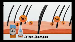 Selsun AntiDandruff Shampoo [upl. by Annohsat33]