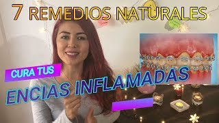 COMO CURAR ENCIAS INFLAMADAS REMEDIOS CASEROS PARA ENCIAS INFLAMADAS TRATAMIENTO PARA ENCIAS [upl. by Atterahs]