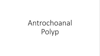 Antrochoanal Nasal Polyp  ENT [upl. by Gridley]