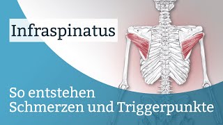 Infraspinatus Schmerzen Triggerpunkte und deren Aktivierung [upl. by Osmond]