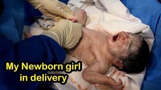 My newborn girl was born in painful delivery viralbaby delivery [upl. by Goldshlag586]