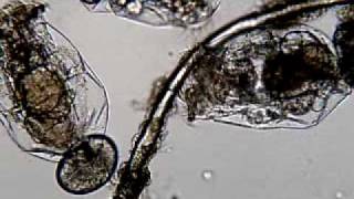 Rotifers under microscope [upl. by Zohara]