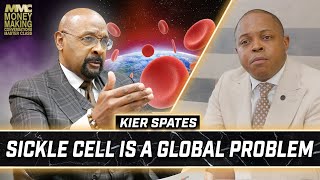 Kier quotJuniorquot Spates speaks on the Global Impact of Sickle Cell  Money Making Conversations [upl. by Lanie]