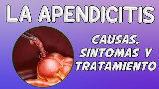 ¿Qué es la apendicitis [upl. by Chilt]