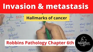 Invasion and Metastasis Hallmarks of CancerRobbins pathology chapter 6Neoplasiarobbinspathology [upl. by Rramaj]