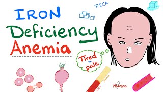 Iron Deficiency Anemia  All you need to know  Causes Symptoms Diagnosis Treatment [upl. by Lucilla]