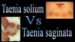 Difference between Taenia solium and Taenia saginata  Tsolium Vs Tsaginata [upl. by Hill]