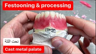 FESTOONING AND PROCESSING AN UPPER DENTURE CAST METAL PALATE waxbae [upl. by Leur]