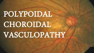 OCT in PACHYCHOROIDAL VASCULOPATHY [upl. by Hagerman]