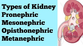 Types of kidney Pronephric Mesonephric Opisthonephric Metanephric for NEET BSc MSc CSIR [upl. by Criswell]