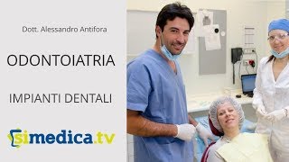 IMPLANTOLOGIA DENTALE Tutto quello che cè da sapere in 10 domande [upl. by Laflam]