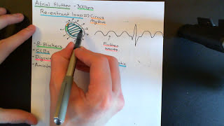 Cardiac Arrhythmias Part 5 [upl. by Malachi]