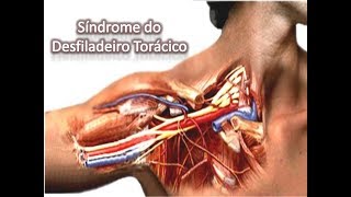 SÍNDROME do DESFILADEIRO TORÁCICO EXAME TESTES ORTOPÉDICOS Clínica de Fisioterapia Dr Robson Sitta [upl. by Ecnaled]