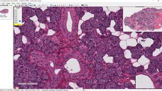 Unit 3 histo  Parotid Gland [upl. by Baumann]