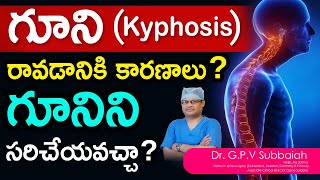 What is Kyphosis Can Kyphosis be corrected  I Kyphosis I scoliosis treatment I Dr GPV Subbaiah [upl. by Nepean]