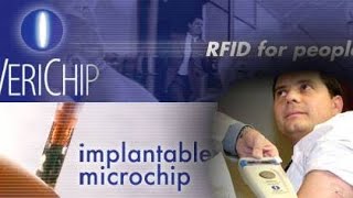 RFIDchip Diabetiker Control [upl. by Nev]